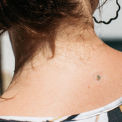 Solución natural para los sofocos de la menopausia | Síntomas de la menopausia | Womanhood| 